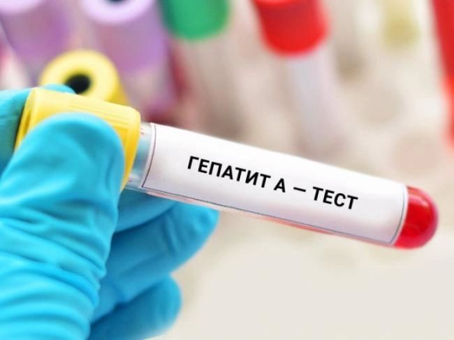 На Рівненщині стартує тиждень безкоштовного тестування на вірусні гепатити: де можна перевіритися