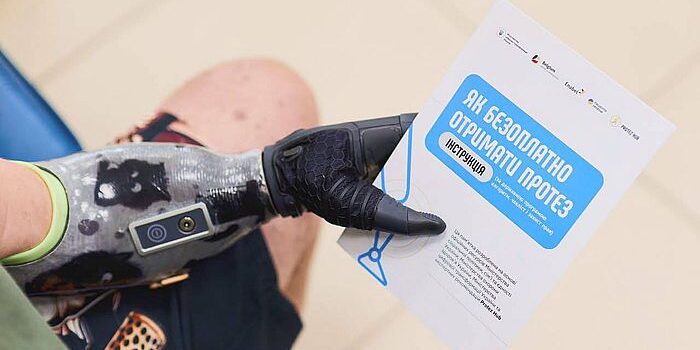 У 25 ЦНАПах Рівненщини облаштували зони для підзарядки протезів